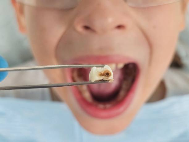 Best Broken Tooth Emergency  in Port Carbon, PA